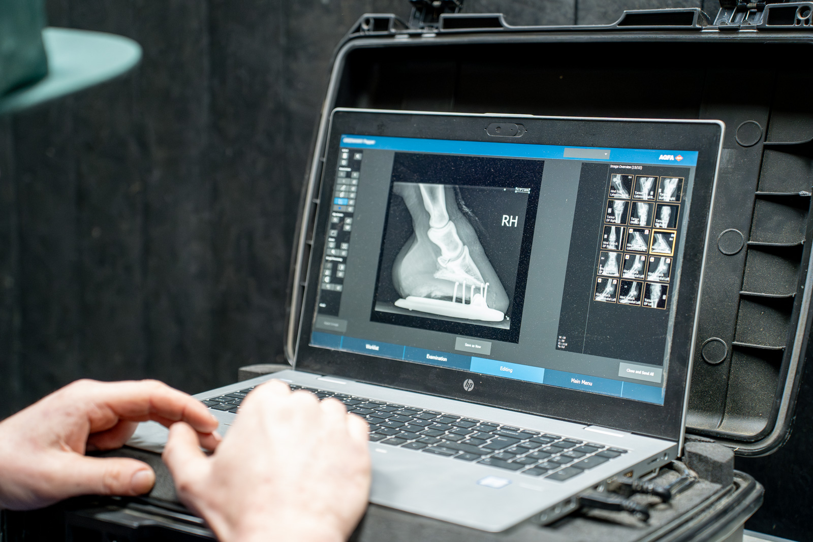 Mobile Digital Radiography